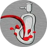 <b>Asociación de urólogos de minima invasión</b> img litiasis