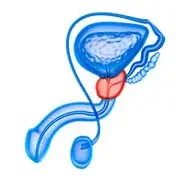 <b>Asociación de urólogos de minima invasión</b> img litiasis